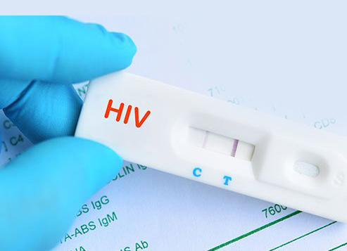 treatment of hiv