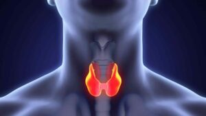 Thyroid Cancer: Symptoms and Treatment